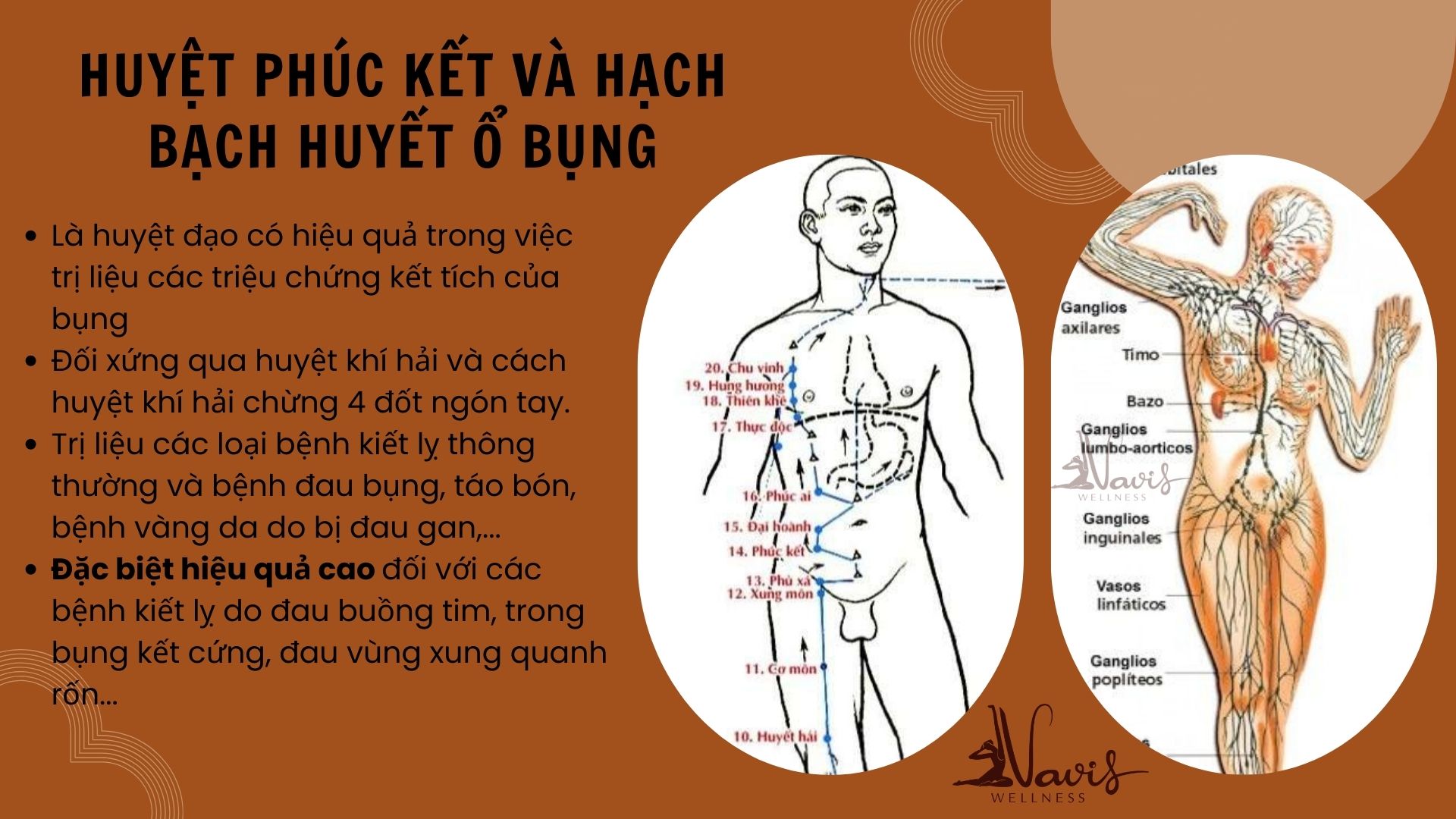 HUYỆT PHÚC KẾT VÀ HẠCH BẠCH HUYẾT VÙNG Ổ BỤNG